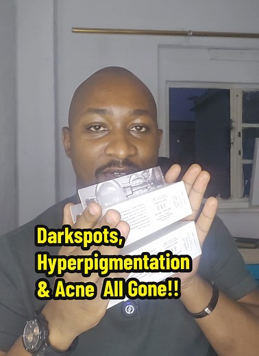 Dark Spots, Hyperpigmentation & Acne Helped by Dr Althea Cream