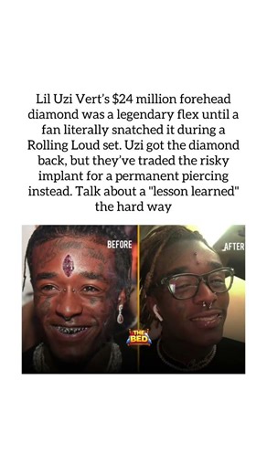 Lil Uzi Vert: The $24M Diamond Saga; Beauty and Pain #shorts #liluzivert #viral