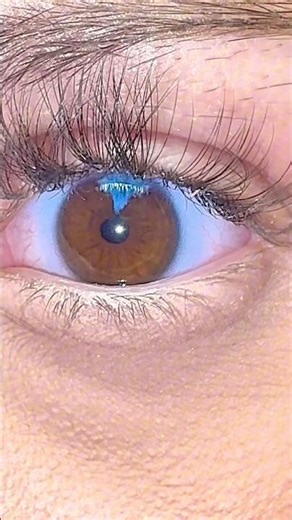 This trend but I have sectoral heterochromia 🦋🧸 #heterochromia#rareeyes#uniquefeatures#shorts