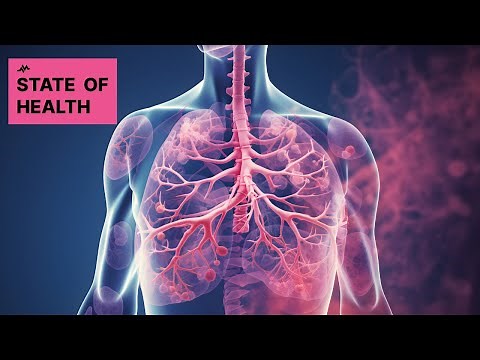 Amivantamab: A New Hope for Lung Cancer Patients