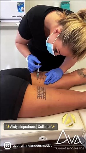 ✨ Alidya Injections Training! ✨ 💉Alidya Injections are used to reduce cellulite. The treatment improves cell metabolism which inhibits the development of cellulite! 👉 This is just one of many courses taught within our Belfast training academy, to find out more about our courses DM us or check out our website www.avacosmetics.co.uk #alidya #aestheticstrainingacademy #aesthetics #beautyandaesthetics #foryoupage #cellulite