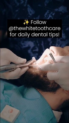 👉 Why Your Teeth Feel Sensitive 😖🦷