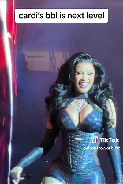 Cardi B's Next Level BBL: What You Need to Know
