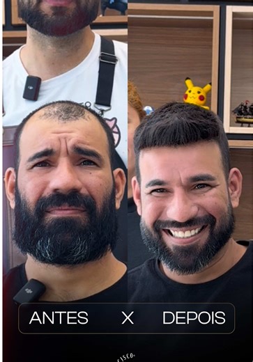 Comente a palavra “CONTATO”. Por muito tempo, o boné fez parte da rotina dele. Não por estilo… mas por não se sentir bem sem. O boné era proteção, era escudo, era a forma de esconder algo que desanimava todos os dias. Quando ele chegou até mim, deu pra sentir isso no olhar. A baixa autoestima, o incômodo constante, a sensação de não se reconhecer mais. E aí veio a transformação. Quando ele se olhou no espelho, demorou alguns segundos pra acreditar. O sorriso veio tímido… e logo depois, veio a em