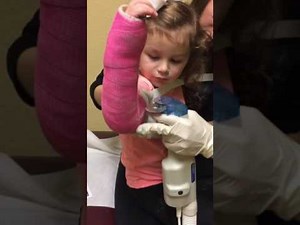 Removing Arm Cast from child
