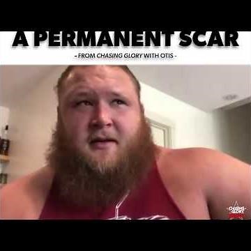 Otis WWE : Bullying Can Leave A Scar