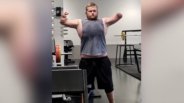 Man’s Unstoppable Gym Workouts With No Arms and Legs