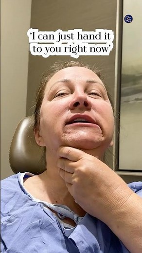 Natural Results| Deep Plane Face & Neck Lift| 1 Year Post-Op #beverlyhillsplasticsurgery