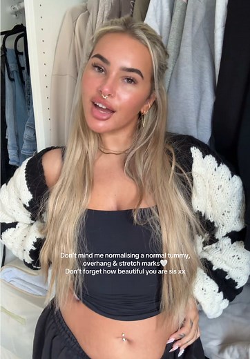 Embracing Body Positivity: Loving Our Natural Bodies