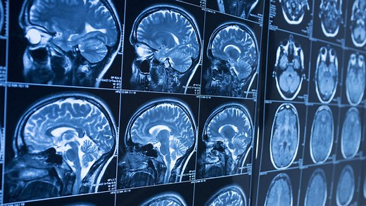 Neuroscience BSc | King's College London