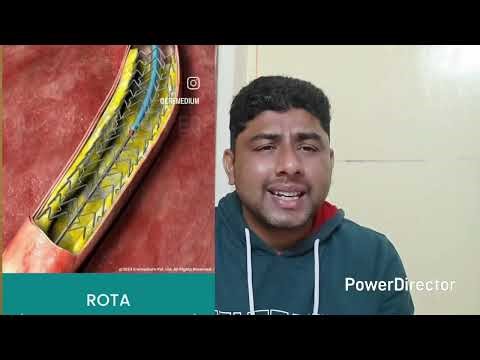 Rotablation Angioplasty