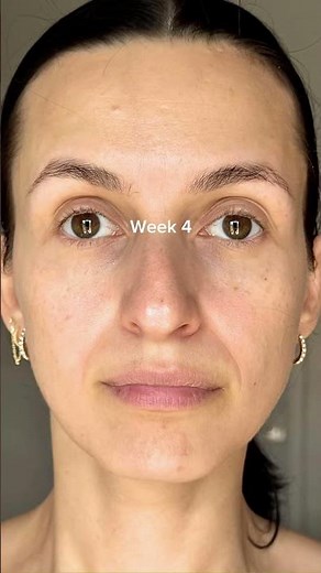 Try an LED Mask for 30 days with me (watch till the end for the results)