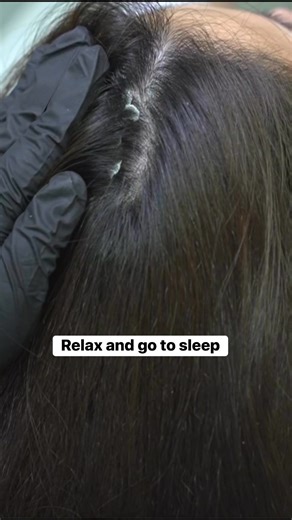 ASMR relaxing sound scratch #scalpcare #hair #dandruff #removingdandruff #hairasmr #longnails #hotstuff #relaxing #satisfying | Rosemary Chigaemezu Alokam