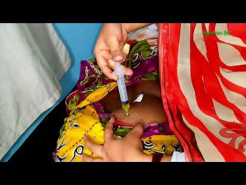 IVF Buttock injection. Calcium Gluconate With Vitamin B Complex Injection Push.injection bd