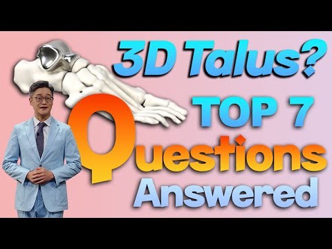 Top 7 Questions About 3D Talus. Total Talus Replacement. Talus Fracture. Talus AVN
