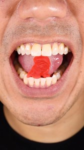 ASMR Dinosaur Gummy #DoctorTristanPeh | Doctor Tristan Peh