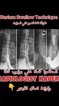 Barium Swallow Technique المحاضرة كاملة من هنا 👆