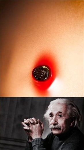 How a Pilonidal Cyst Forms: The Hidden Role of Hair 😦 #PilonidalCyst#MedicalFacts#HealthAwareness