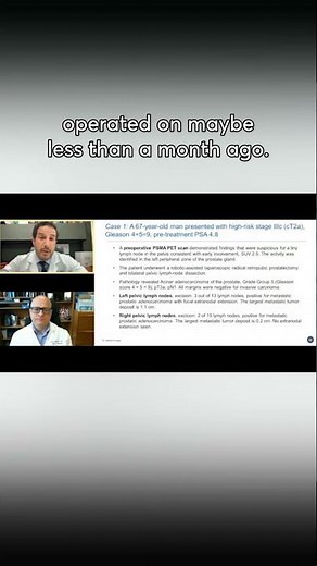 PSMA PET Imaging: Transforming Treatment Approaches