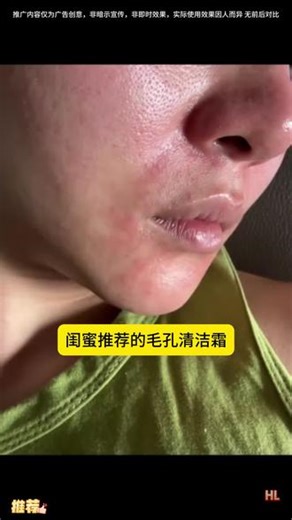 毛孔清洁神器！皮肤光滑细腻！#施逅SEOMOU毛孔清洁霜 #毛孔清洁霜
