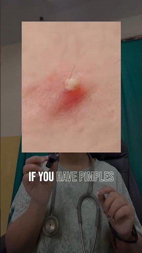 Dermatologist Doctor Explained | Skin, Hair & Nail Care | Know your Doctor