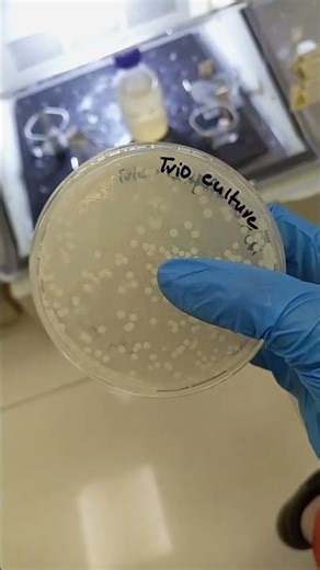 Mix bacteria and trichoderma culture
