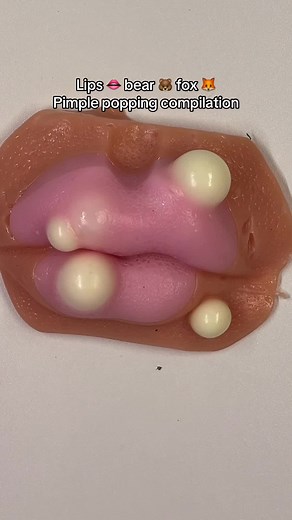 Lips, Bear, Fox! Satisfying ASMR Pimple Popping Compilation