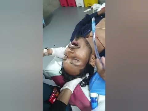 Extradural Hemorrhage Evacuation under General ANESTHESIA