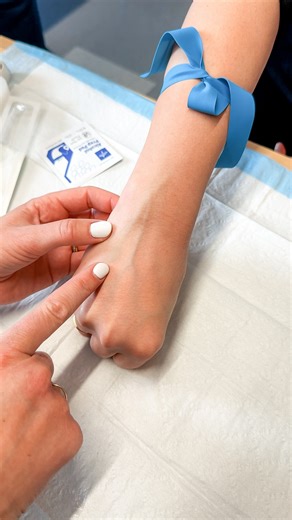 Kristine Tuttle on Instagram: "IV Start Tips 👀🩸 ⁠ ⁠ 🩸 Rolling veins⁠ A rolling vein moves easily when touched. It can look straight and perfect, you’re on track to insert, and BOOM…it rolls away from you. So be sure to ANCHOR that vein firmly when inserting to prevent it from rolling. ⁠ ⁠ 🩸 Avoid bifurcations⁠ This is when the vein divides into two branches, or “forks.” If you were to start an IV in a bifurcation, you would blow the vein or be unable to advance the catheter since you’re hitt