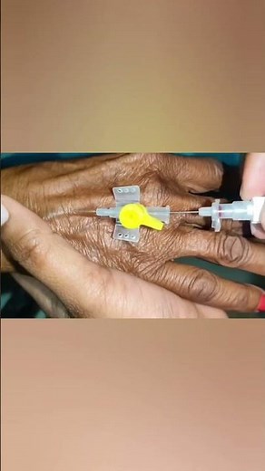 iv cannulation#hospital #youtube#youtuber #youtubeshorts #youtubeshort #vigo #emergency #icu