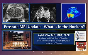 RSNA 2022:：前列腺磁共振与分子影像学核心技术与先进技术（Prostate MRI and Molecular Imaging ）