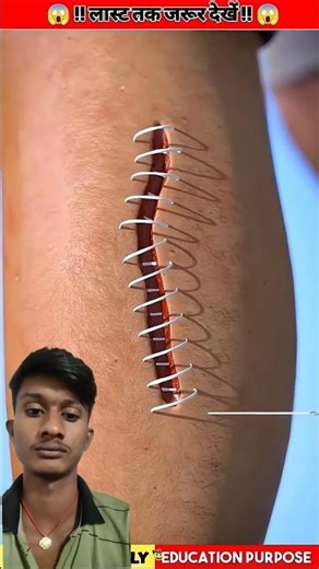 Where Does the Thread Go When Doctors Stitch a Wound? | Facts 3D Animation