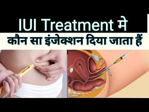 Injections in IUI Treatment #iui #iuisuccess #injectionsforiui ‪@helpbyreetu‬