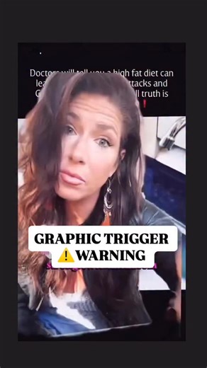 GUT PAIN isn’t random, your body is trying to tell you something !! Did you know different areas of gut pain can point to toxic overload, parasites, or sluggish drainage? Here’s what common pain spots might mean: Gallstones - bile backup, liver flukes, poor fat digestion Heartburn - gut dysbiosis, low stomach acid, parasite byproducts Gastritis - inflammation from toxins or chronic gut stress Kidney stones - mineral imbalance, heavy metals, dehydration Appendicitis - some believe parasites can i