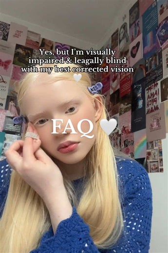 Understanding Albinism FAQs and Visual Impairment