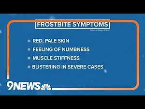 Meteorologist explains frostbite and tips on how to avoid it