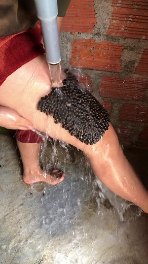 She was taking the tick to relieve the pain she poured water on it #lice #fyppppppppppppppppppppppp