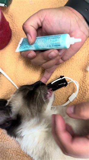 Skill #20 Administering Eye Ointment