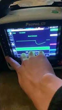 ZOLL Propaq MD Monitor/Defibrillator 30 Joule Test and Self Test