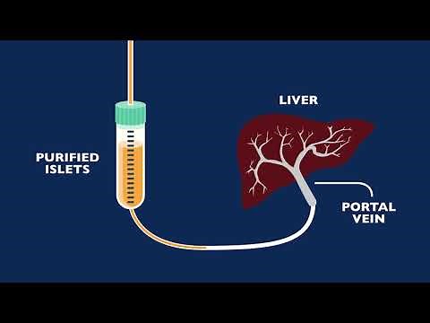 Auto Islet Transplant Program