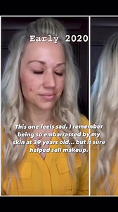 This is the reason I’m so passionate about my skincare routine. I was almost 40 years old with breakouts, scars and an uneven skin tone… then enter the “Danger Danger Game Changer” which truly did change my game. Right now you can save 20% off ALL face collections (the basics are VERY affordable and will give amazing results), plus $.99 shipping, plus $20 off $100 orders, plus a free gift with $150 orders, plus cash back on every purchase (and if you’re already a customer, apply your previous re