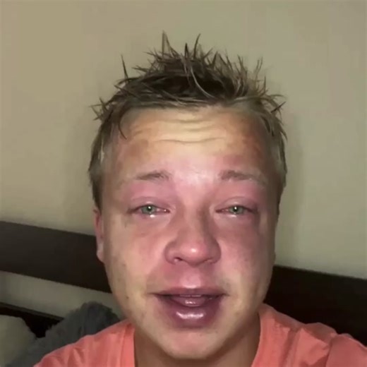 How to Cook Eggs in a Microwave Without Messing Up