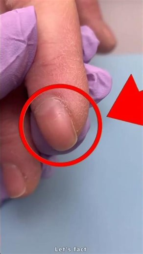 This Dangerous Signal For Your Health 😨