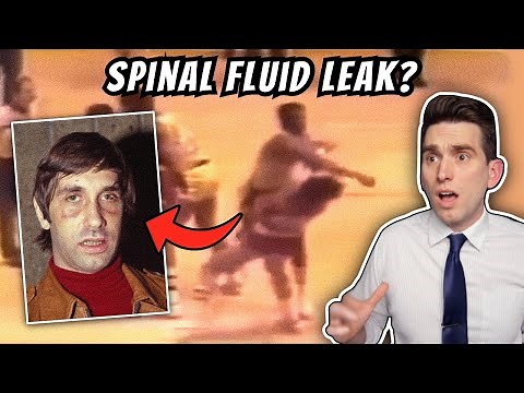 The Untold Side of the Most Infamous Punch in NBA History - Doctor Explains Rudy Tomjanovich Injury