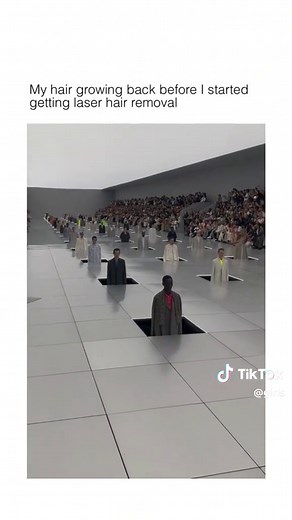 Effective Leg Hair Removal with Laser Technology