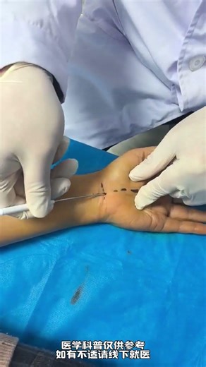 Carpal Tunnel Syndrome Relief: Numb Hands, Swelling, & Weakness Solve