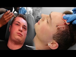 I HAD TO GET SURGERY..