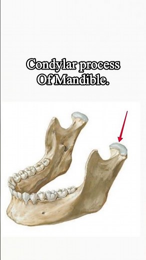Osteo#Mandible#Condylar process #