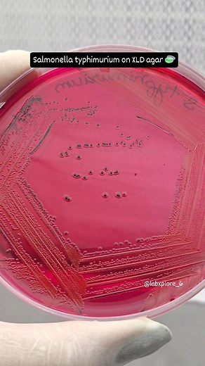 LabXplore on Instagram: "S.typhimurium forming black colonies on XLD agar 🧫🔬👀 . #labxplore #microbiology #biotechnology #media #culture #bacteria #lab #xld #blackcolonies #pinks #medium #salmonella #typhimurium #content #shortsvideo #reelsinstagram #likeback #followme #shareforshare #lablife🐾 #student #research #science #streaking #qualitycontrol #qualityassurance #mediaplates"