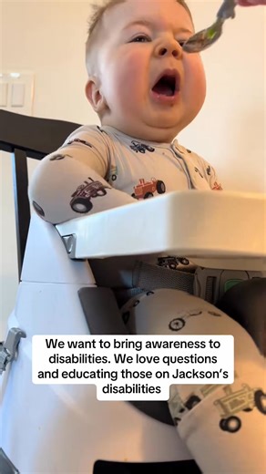 53K views · 1.7K reactions | The miracle of you. #neuromusculardisease #nemalinemyopathy #physical...#Reel #Fbreel #Shorts #Viral | Nybula | Facebook